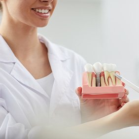 a dentist holding a dental implant model