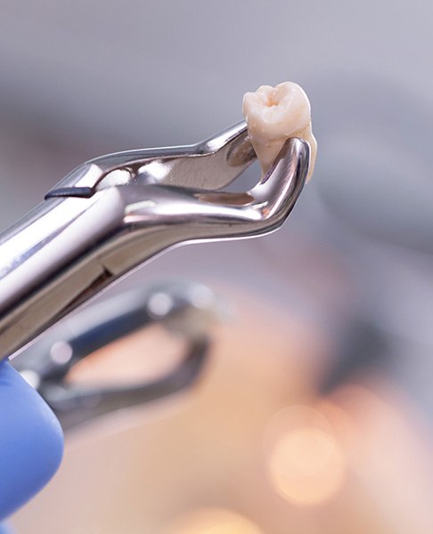 A tooth held in a pair of forceps