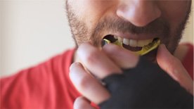 Man placing yellow and black mouthguard in his mouth