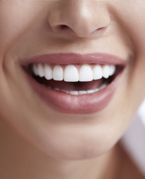 Closeup of healthy smile after fluoride treatment