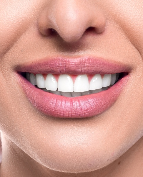 Closeup of beautiful smile after biomimetic dentistry