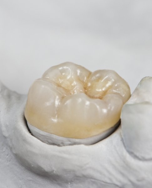 Model smile with dental crown restoration