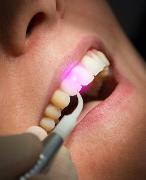 Patient receiving soft tissue laser dentistry treatment