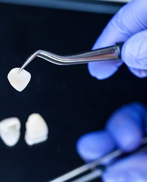 A dentist holding veneers with a tweezer