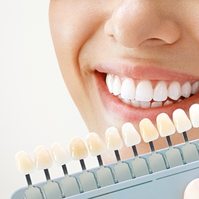 Teeth whitening costs can range from just a few dollars to hundreds of dollars but the results are worth the investment